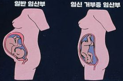 Read more about the article 서래마을 영아 유기사건 그 이후 임신거부증